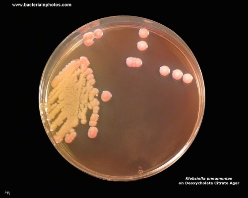 deoxycholate citrate agar klebsiella